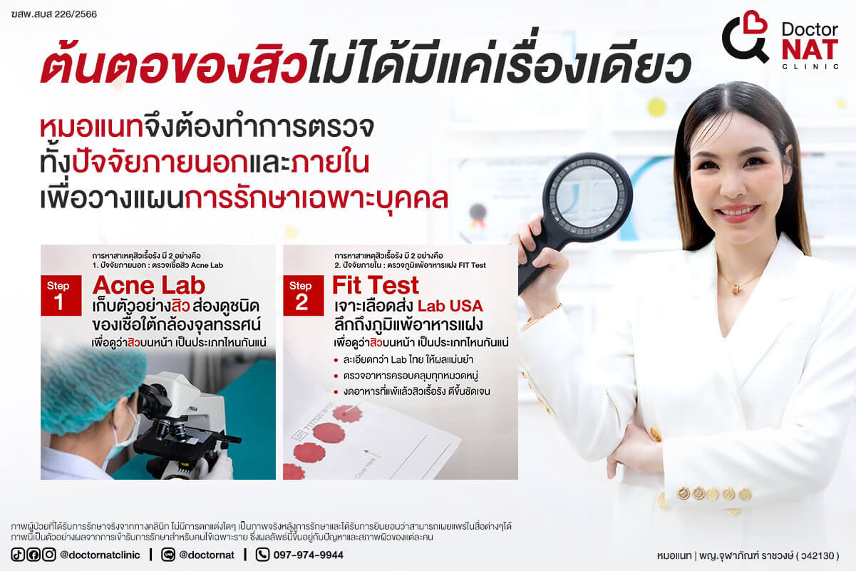 ต้นตอของสิวไม่ได้มีแค่สาเหตุเดียว
