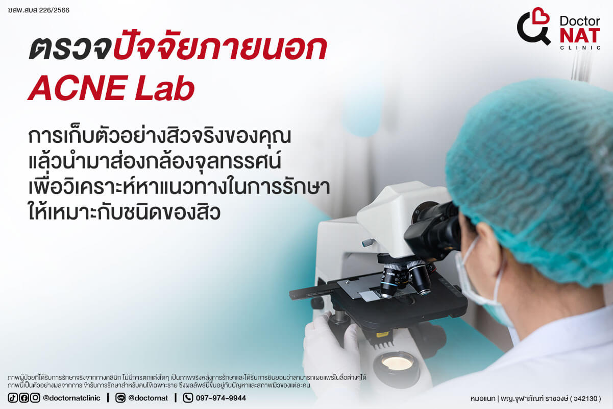 ACNE Lab การตรวจหาต้นตอปัญหาสิว