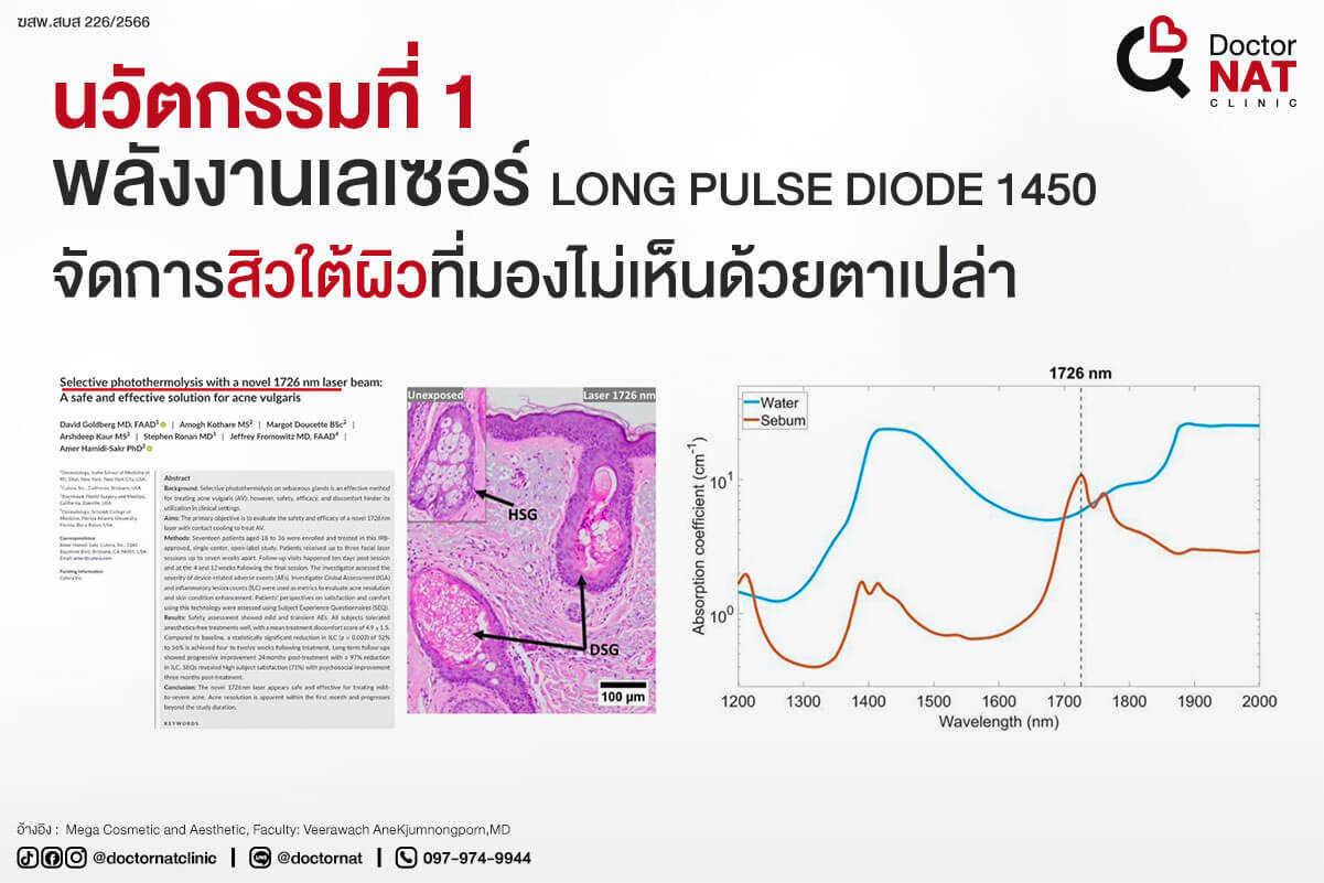 นวัตกรรมที่ 1 
พลังงานเลเซอร์ LONG PULSE DIODE 1450
จัดการสิวใต้ผิวที่มองไม่เห็นด้วยตาเปล่า