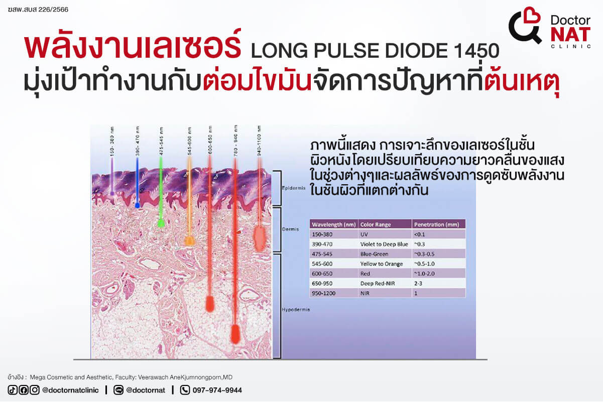 ทำไมความยาวคลื่น 1450 ถึงเหมาะกับการรักษาสิว?