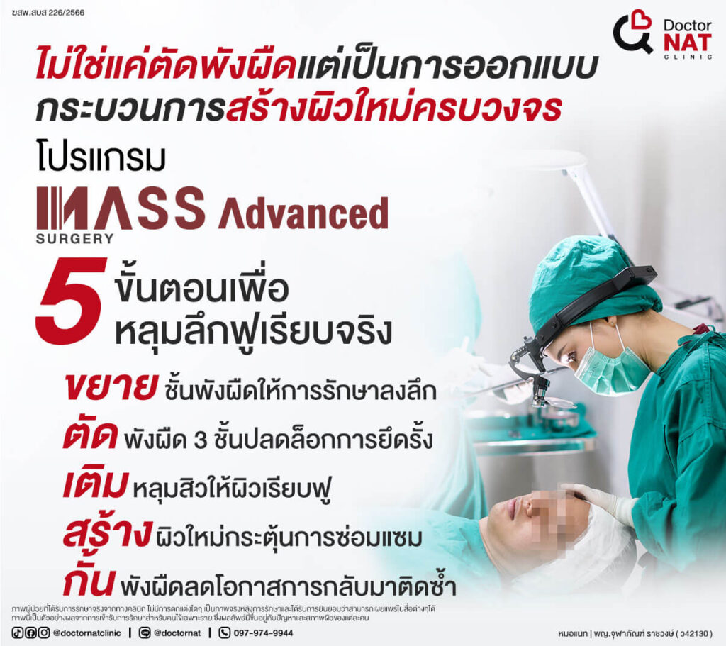 โปรแกรมศัลยกรรมหลุมสิวกวาดตัดพังผืด 3 ชั้น 
พร้อมสร้างแนวกั้น
MASS Advanced Surgery

Doctor NAT Clinic