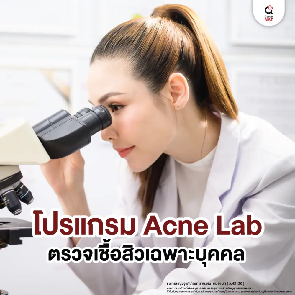คลินิกรักษาสิว ดอกเตอร์แนทคลินิก บริการ Acne Lab ตรวจหาเชื้อสิวเฉพาะบุคคล