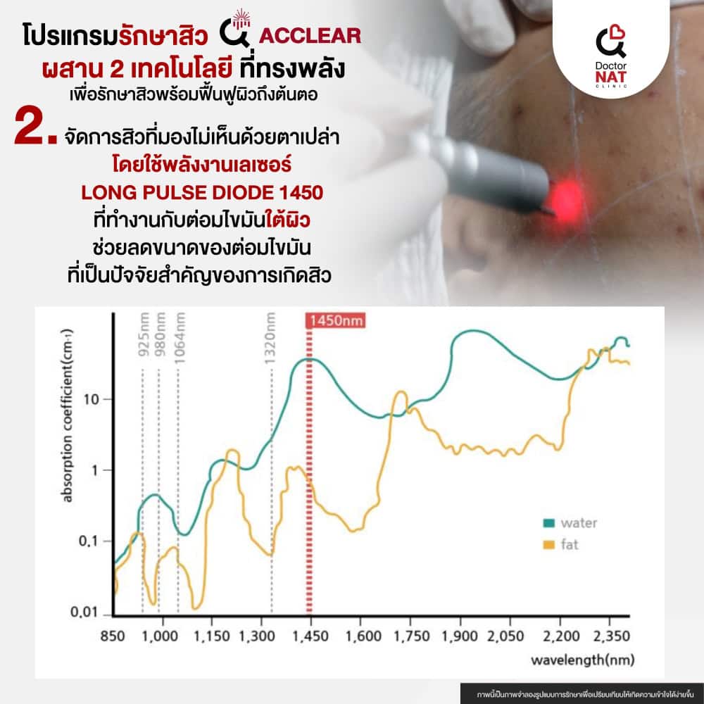 สิวขึ้นหลัง สิวขึ้นหน้าอก สามารถรักษาได้ที่ดอกเตอร์แนทคลินิก