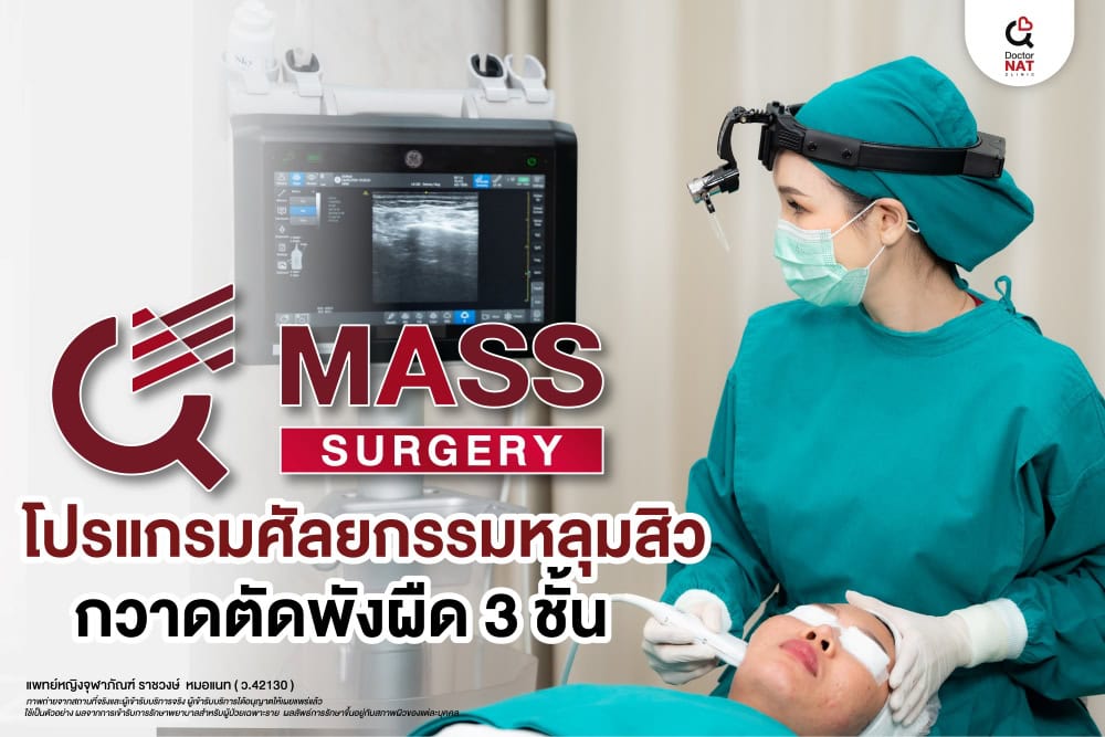 โปรแกรม MASS Surgery ช่วยรักษาหลุมสิว