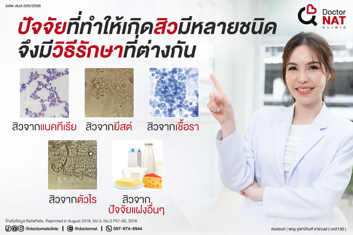 สิวมีหลายประเภท 
จึงมีสาเหตุและวิธีรักษาที่แตกต่างกัน