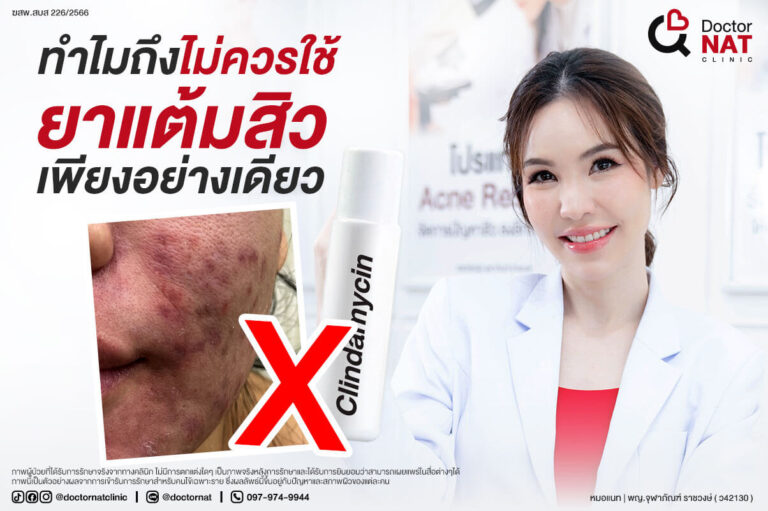 วิธีดูแลสิวที่ถูกต้อง ไม่ควรใช้ยาแต้มสิวเพียงอย่างเดียว เพราะสิวอาจดื้อยาได้ รู้วิธีดูแลสิวด้วยตัวเองตามระดับความรุนแรง พร้อมตรวจต้นเหตุสิวที่ Acne Lab กับหมอแนท Doctor Nat Clinic