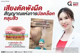 เสียงตัดพังผืด สัญญาณแห่งการปลดล็อคหลุมสิว Doctor NAT Clinic