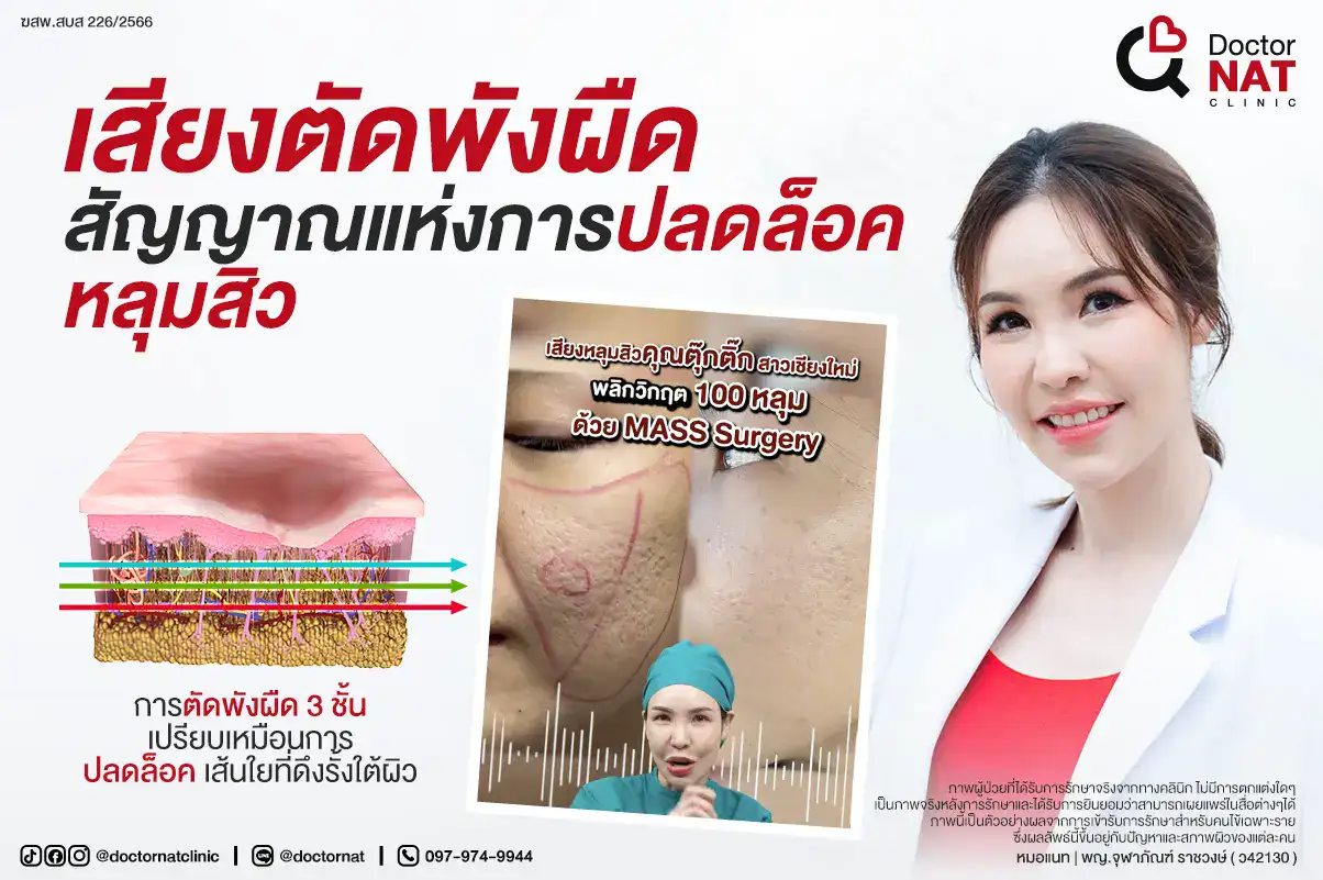 เสียงตัดพังผืด สัญญาณแห่งการปลดล็อคหลุมสิว Doctor NAT Clinic