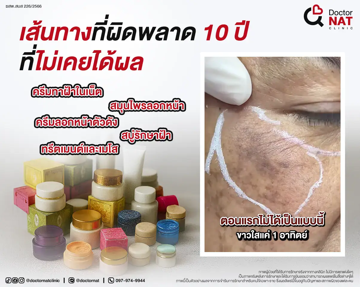 วิธีรักษาฝ้าที่ผิดพลาด ยิ่งรักษายิ่งลาม