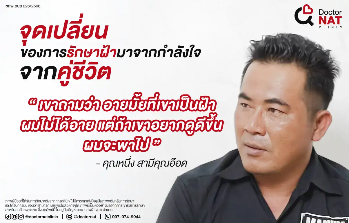 จุดเปลี่ยนของการรักษาฝ้า
มาจากกำลังใจและแรงสนับสนุน...จากคู่ชีวิต