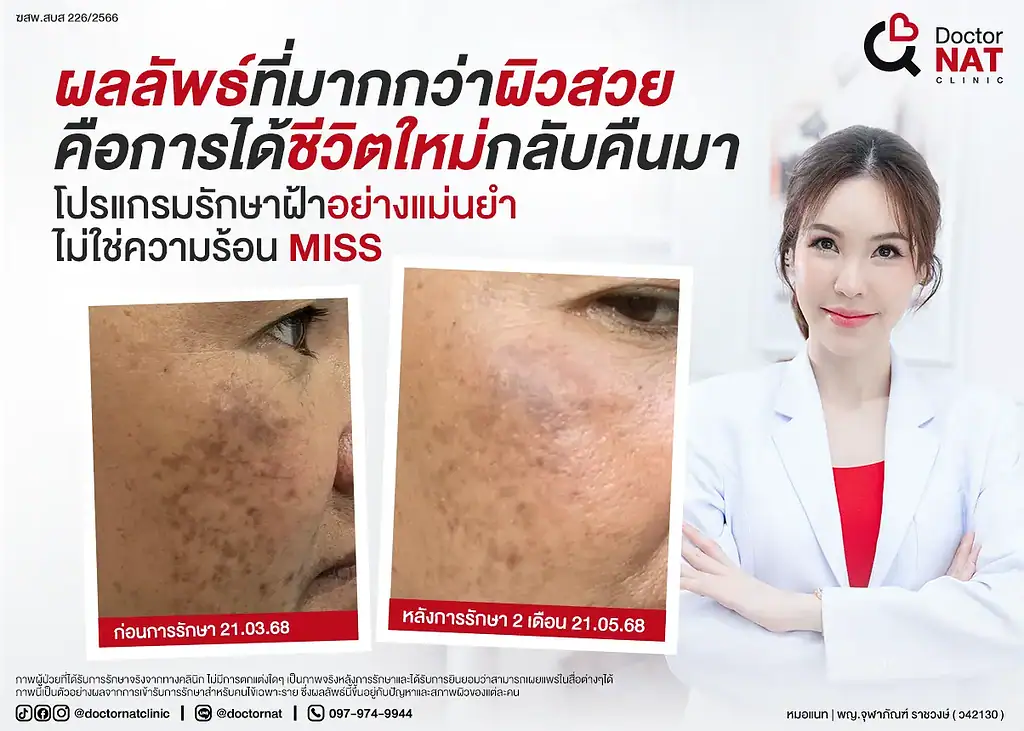 ผลลัพธ์ที่มากกว่าผิวสวย
คือการได้ชีวิตใหม่กลับคืนมา