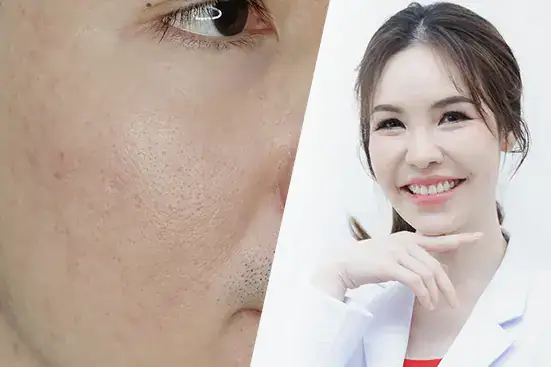 โปรแกรมจัดระเบียบคอลลาเจน