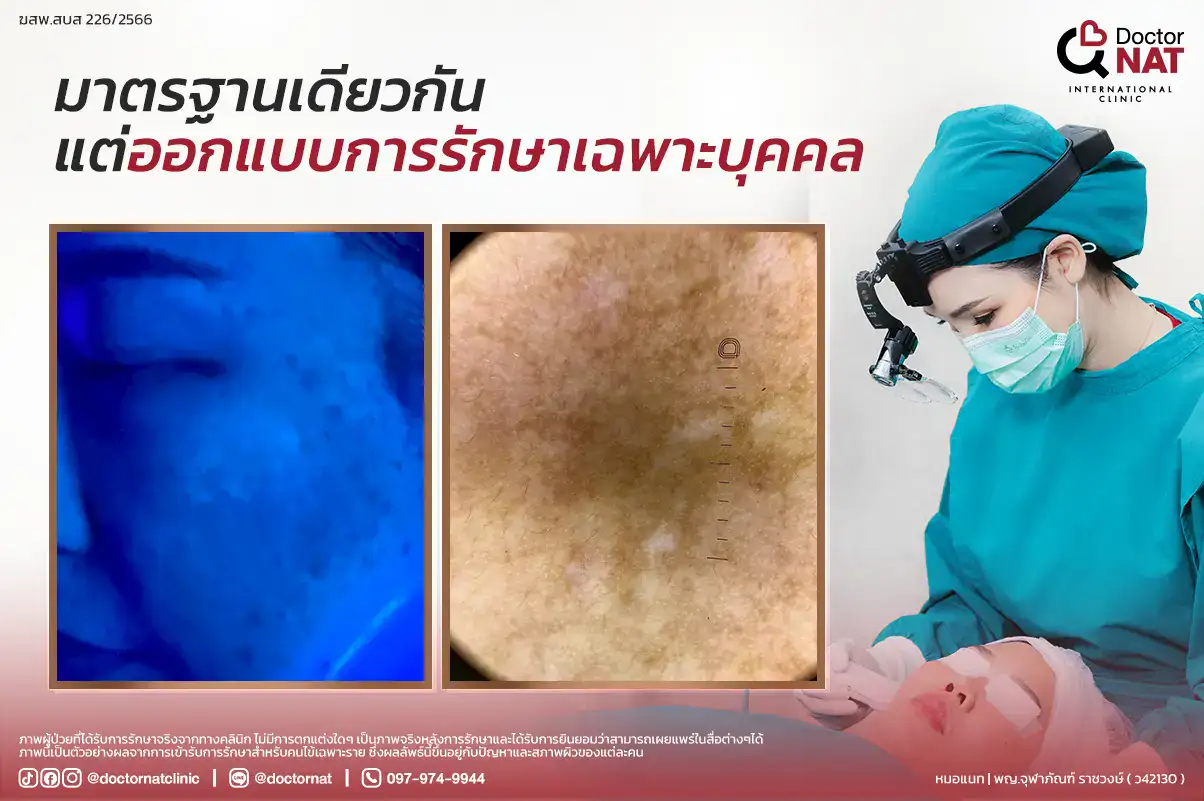 มาตรฐานเดียวกันแต่ออกแบบการรักษาเฉพาะบุคคล