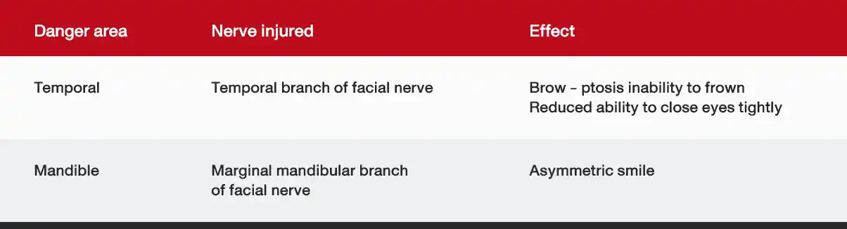 Danger Area of Subcision