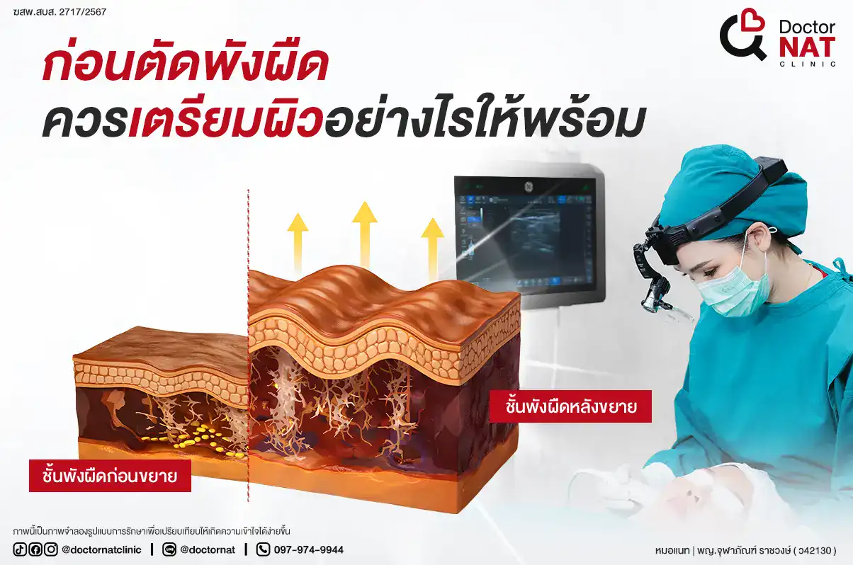 ก่อนตัดพังผืด ควรเตรียมผิวอย่างไรให้พร้อม