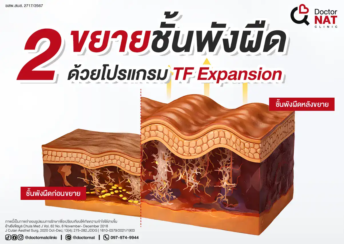 การเตรียมผิว ก่อนตัดพังผืด