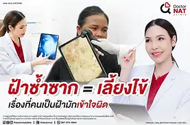 ฝ้าซ้ำซาก เรื่องจริงที่คนมักเข้าใจผิด