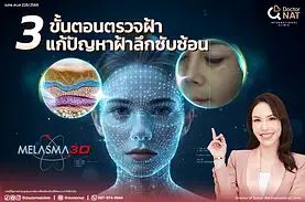 Melasma Mapping 3D ตรวจฝ้า 3 มิติก่อนรักษาฝ้า
