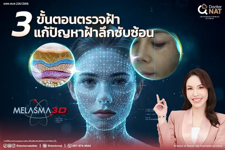 Melasma Mapping 3D ตรวจฝ้า 3 มิติก่อนรักษาฝ้า
