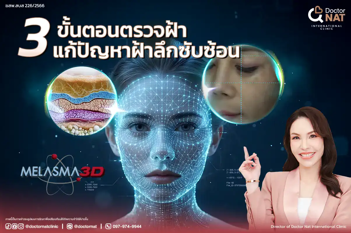 Melasma Mapping 3D ตรวจฝ้า 3 มิติก่อนรักษาฝ้า