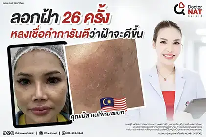 รีวิวรักษาผิวเสียจากการลอกฝ้าเคสจริง