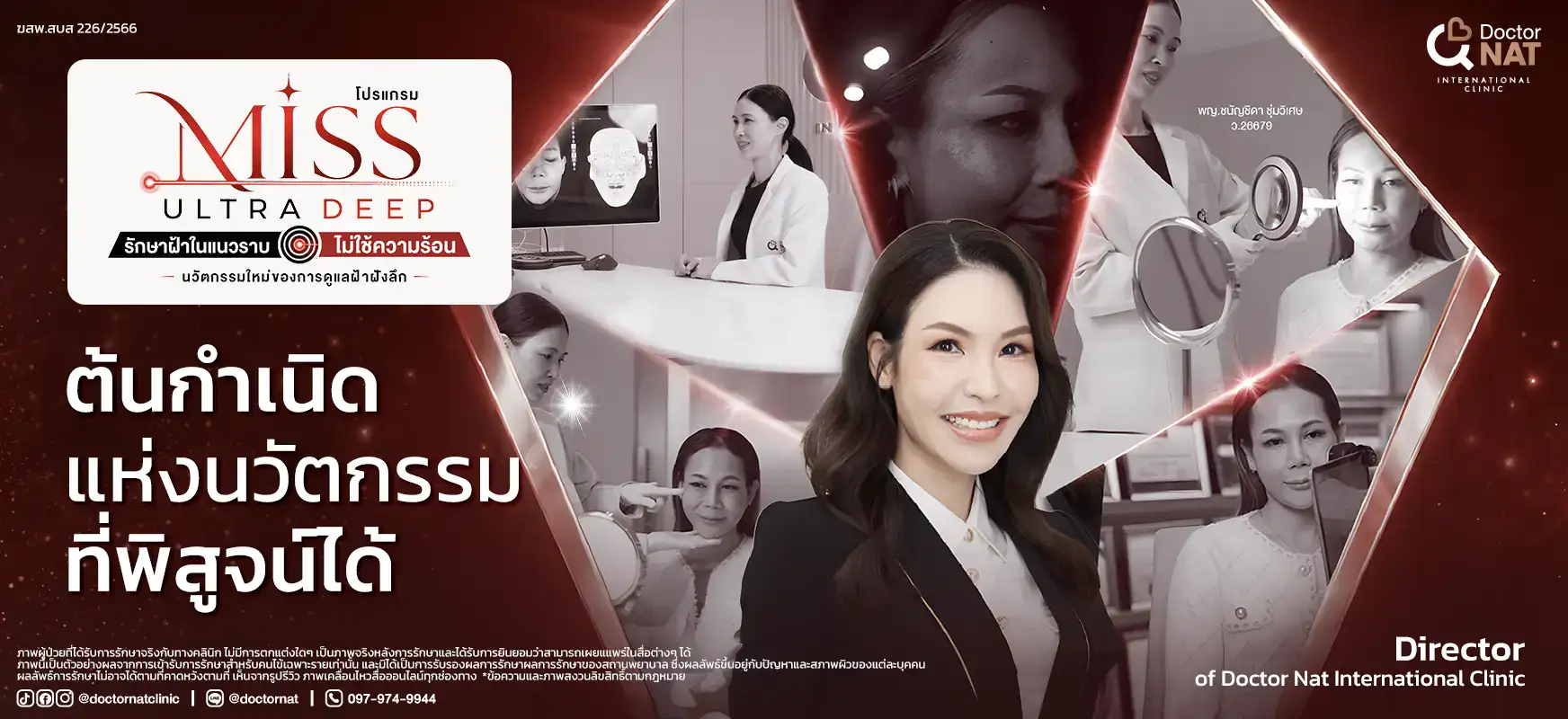 MISS Ultra Deep นวัตกรรมรักษาฝ้า